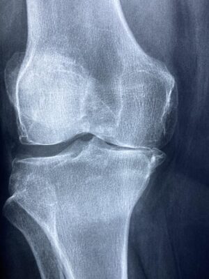 Assistenzarzt (m/w/d) Orthopädie und Unfallchirurgie in einer Rehaklinik