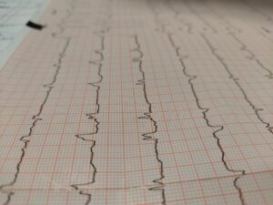 Assistenzarzt Kardiologie (m/w/d) mit deutscher Approbation